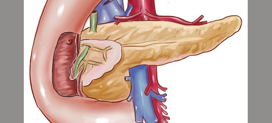 de10512d796c2ec28f114190de999ed0