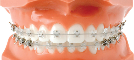 e4e49f1f003ebe36977eabde105ae8e1