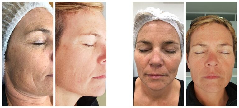 a2f88f2867f880ba7fe1a077d444ebe5