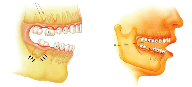 24acd0cd642fba1838fb8c302c65d6e3