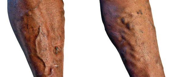 a264553b1cdada5668e893367eac1f50