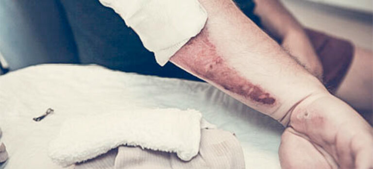 a46d3aecd3b7fdbe0e97947c100af8b3