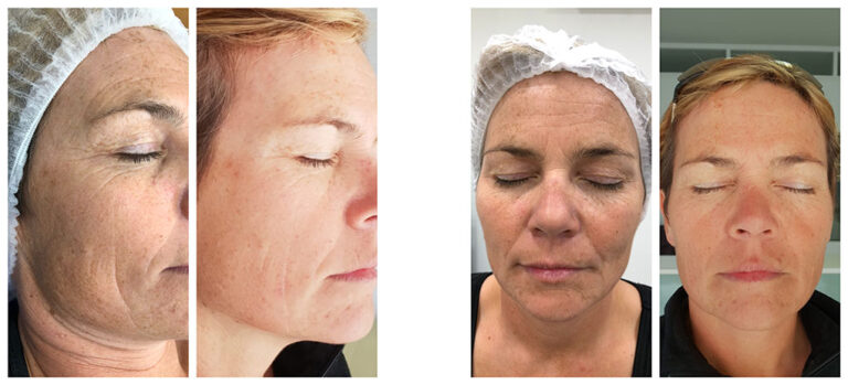 b50329863cf76d15b40dc74a7382669e